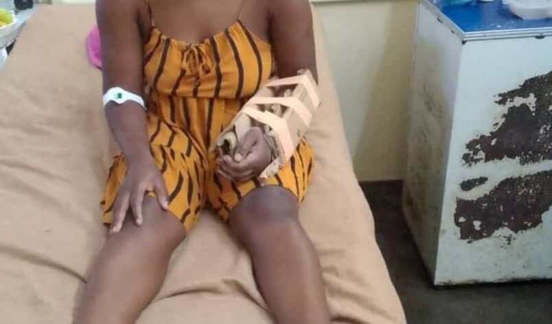 Zimbabwe Hospitals Use Cardboard as Casts in Road Crash Crisis