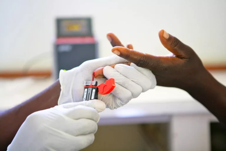 A Zimbabwean health worker administers an HIV test | Report Focus News